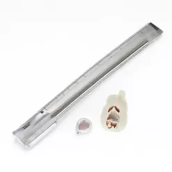 How Dental Rulers Improve Precision in Root Canal Procedures