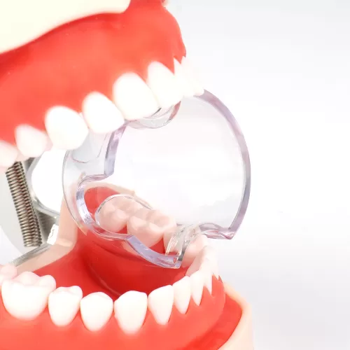 Dental Retractor(Posterior Teeth)